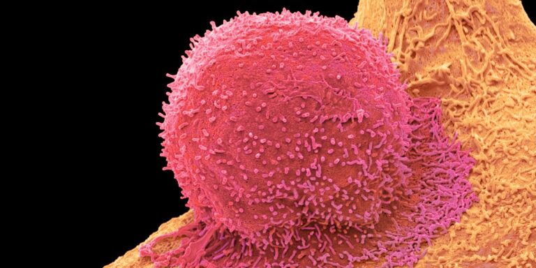 Revolutionary new cell therapies may lastly get at tough-to-target cancers