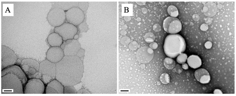 Advancing Therapy for Visceral Leishmaniasis with Nanomedicine