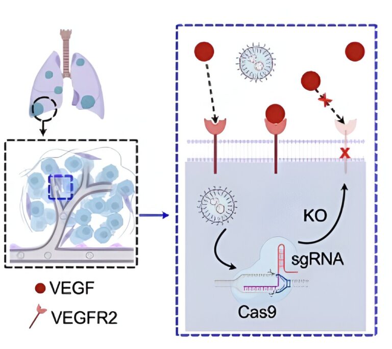 Engineers goal lung illness with lipid nanoparticles