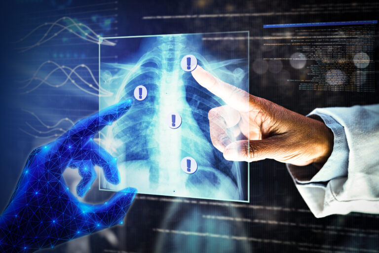 New AI technique captures uncertainty in medical photographs | MIT Information