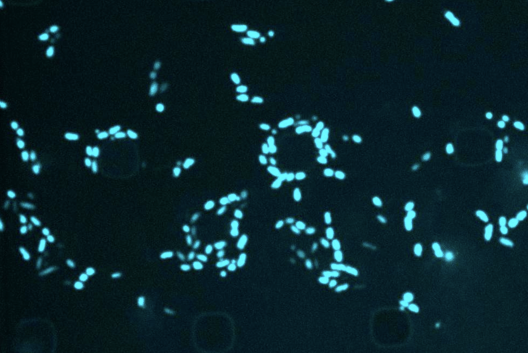 When an antibiotic fails: MIT scientists are utilizing AI to focus on “sleeper” micro organism | MIT Information